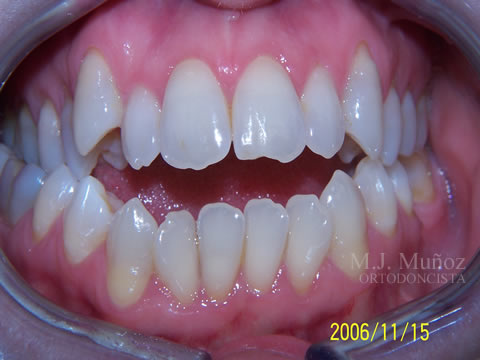 Before image