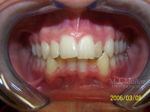 Before image