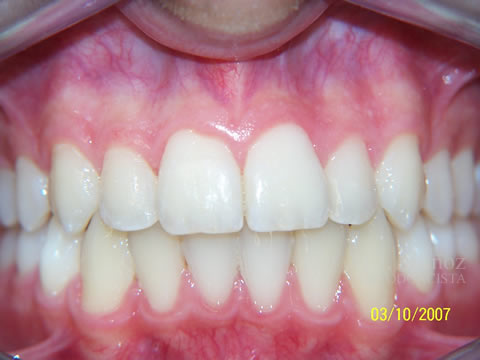 After image