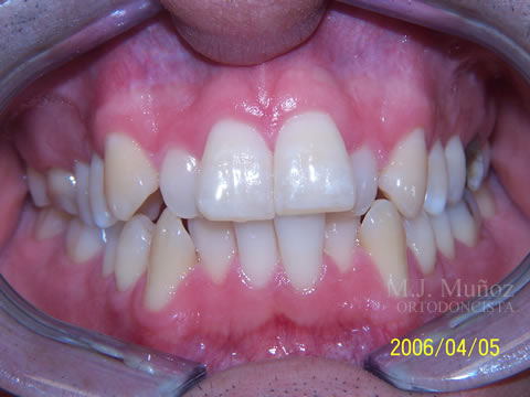 Before image