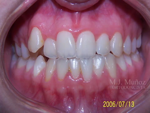 Before image