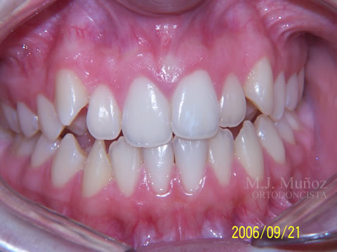 Before image