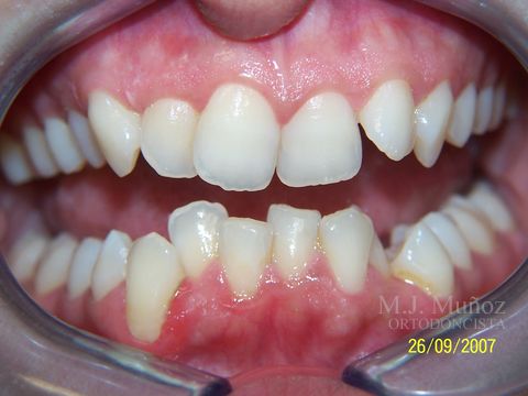 Before image