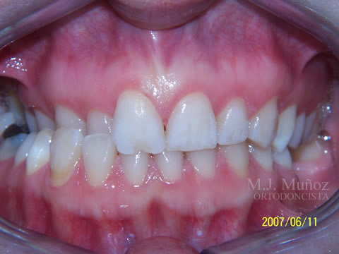 Before image
