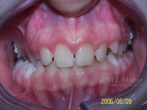Before image