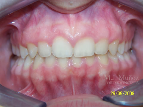 After image