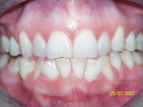 Before image