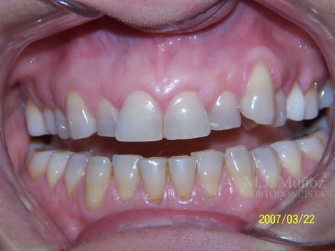Before image