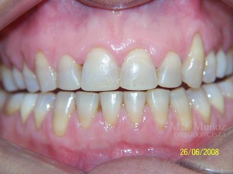 After image