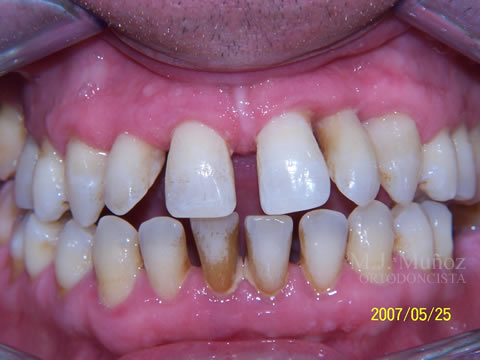 Before image