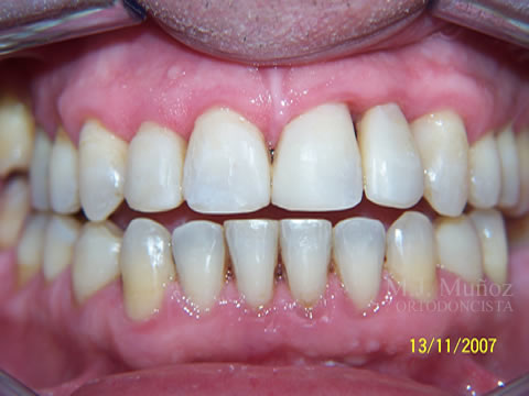 After image