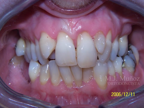 Before image