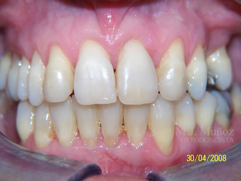 After image