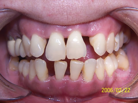 Before image