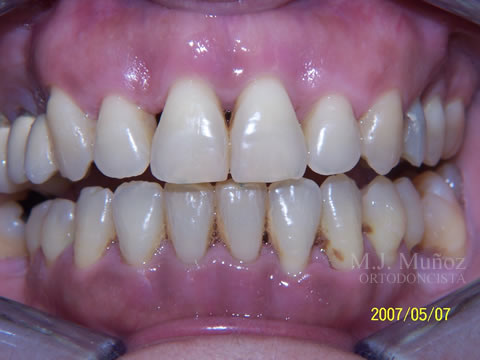After image