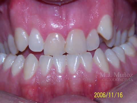Before image