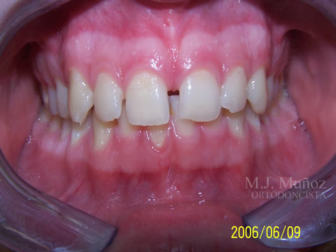 Before image