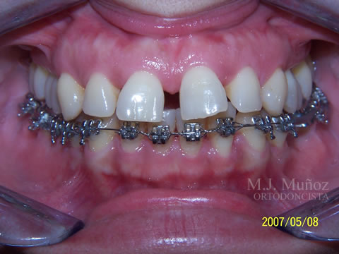 Before image