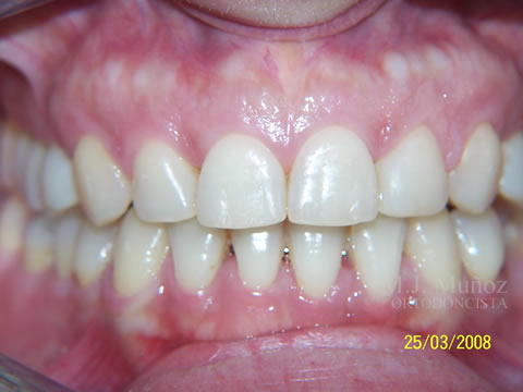 After image