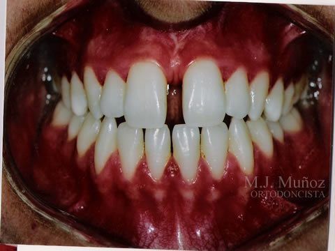 Before image