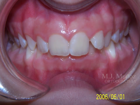 Before image