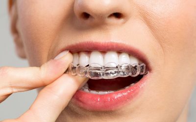 Invisalign y la salud bucal: beneficios adicionales más allá de la estética dental