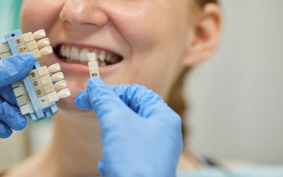 ¿Qué tipos de implantes dentales existen?