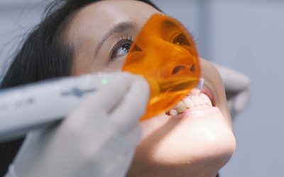 ¿Cómo quitar el sarro de tus dientes?