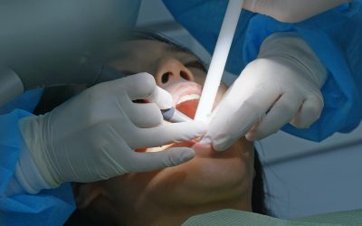 ENDODONCIA UNIRRADICULAR. QUÉ ES Y CUÁNDO ES NECESARIA