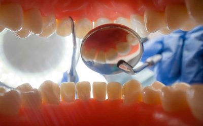 MOVILIDAD DENTAL. SÍNTOMAS Y TRATAMIENTOS