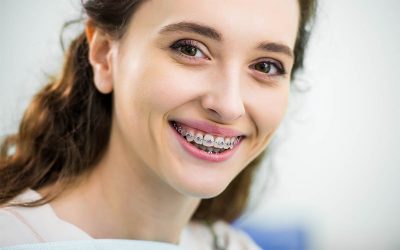 BENEFICIOS DE LA ORTODONCIA PARA TU SALUD DENTAL