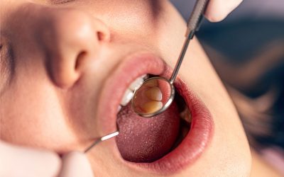 Cuáles son los síntomas de la Osteoporosis mandibular 