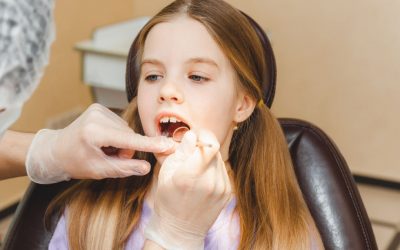 ¿Qué son los dientes o caninos incluidos y cuál es su tratamiento?