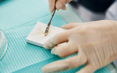 ¿QUÉ ES EL CEMENTO DENTAL?