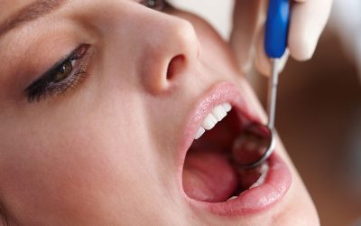 Costumbres que pueden perjudicar el desarrollo oral