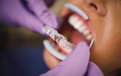 Invisalign para adultos: transforma tu sonrisa, transforma tu vida