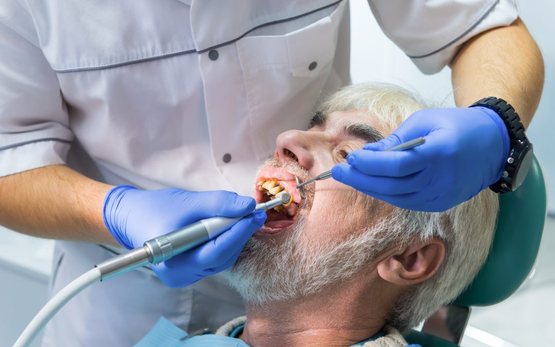 El impacto del tabaco en la salud dental